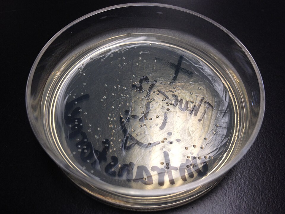 Bacterial colonies on an agar plate