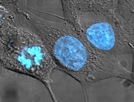 Cultured cells under a microscope